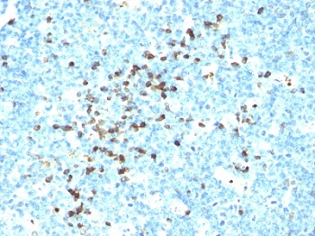 Immunohistochemistry (Formalin/PFA-fixed paraffin-embedded sections) - Anti-Lambda Light chain antibody [LcN-2] - BSA and Azide free (AB233891), expandable thumbnail