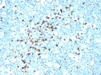 Immunohistochemistry (Formalin/PFA-fixed paraffin-embedded sections) - Anti-Lambda Light chain antibody [LcN-2] - BSA and Azide free (AB233891)
