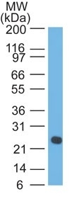 Western blot - Anti-Lambda Light chain antibody [LcN-2] - BSA and Azide free (AB233891), expandable thumbnail