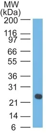 Western blot - Anti-Lambda Light chain antibody [LcN-2] - BSA and Azide free (AB233891)