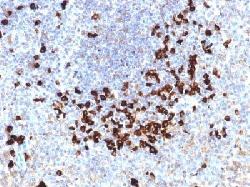 Immunohistochemistry (Formalin/PFA-fixed paraffin-embedded sections) - Anti-Lambda Light chain antibody [LLC/1738] (AB218430)