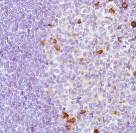 Immunohistochemistry (Formalin/PFA-fixed paraffin-embedded sections) - Anti-Lambda Light chain antibody [SP147] - BSA and Azide free (AB245750)