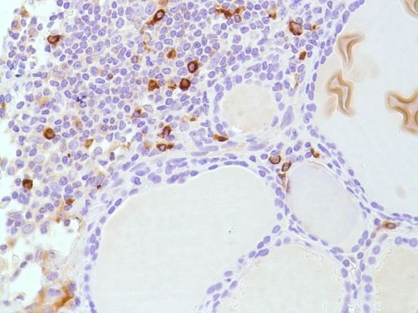 Immunohistochemistry (Formalin/PFA-fixed paraffin-embedded sections) - Anti-Lambda Light chain antibody [SP147] - BSA and Azide free (AB245750)