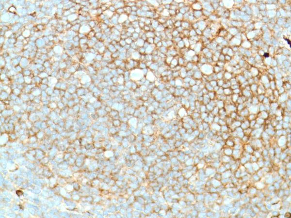 Immunohistochemistry (Formalin/PFA-fixed paraffin-embedded sections) - Anti-Lambda Light chain antibody [SP147] - BSA and Azide free (AB245750)
