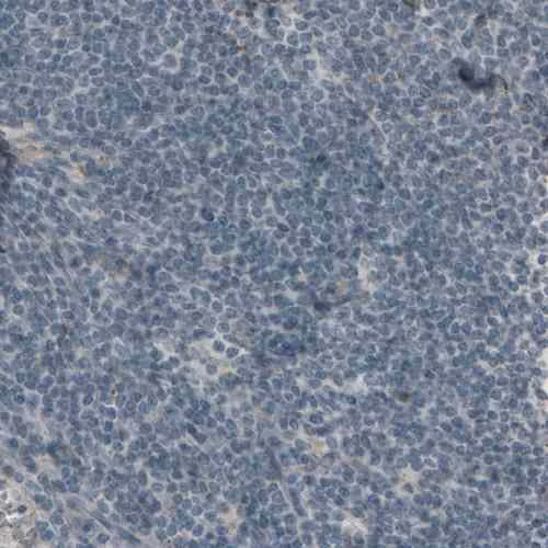 Immunohistochemistry (Formalin/PFA-fixed paraffin-embedded sections) - Anti-LAMC2 antibody [CL2980] (AB210959)