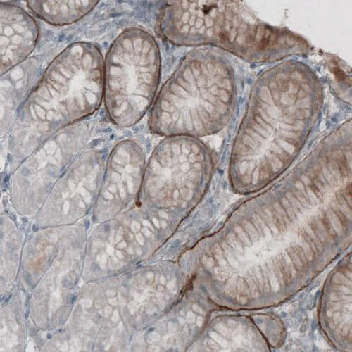 Immunohistochemistry (Formalin/PFA-fixed paraffin-embedded sections) - Anti-LAMC2 antibody [CL2980] (AB210959)