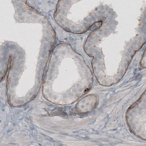 Immunohistochemistry (Formalin/PFA-fixed paraffin-embedded sections) - Anti-LAMC2 antibody [CL2980] (AB210959)