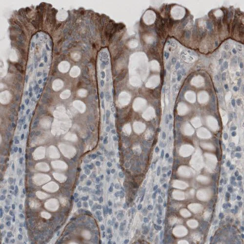 Immunohistochemistry (Formalin/PFA-fixed paraffin-embedded sections) - Anti-LAMC2 antibody [CL2980] (AB210959)
