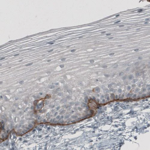 Immunohistochemistry (Formalin/PFA-fixed paraffin-embedded sections) - Anti-LAMC2 antibody [CL2980] (AB210959)