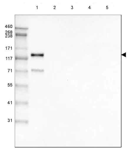 Western blot - Anti-LAMC2 antibody [CL2980] (AB210959)