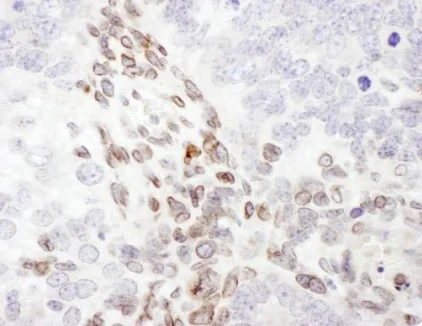 Immunohistochemistry (Formalin/PFA-fixed paraffin-embedded sections) - Anti-Lamin A antibody - Nuclear Envelope Marker (AB226198)