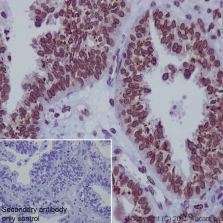 Immunohistochemistry (Formalin/PFA-fixed paraffin-embedded sections) - Anti-Lamin A + Lamin B1 + Lamin C antibody [EPR4068] - Nuclear Envelope Marker (AB108922)