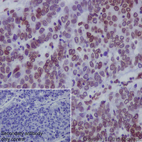 Immunohistochemistry (Formalin/PFA-fixed paraffin-embedded sections) - Anti-Lamin A + Lamin B1 + Lamin C antibody [EPR4068] - Nuclear Envelope Marker (AB108922)
