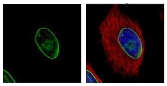 Immunocytochemistry/ Immunofluorescence - Anti-Lamin A + Lamin C antibody (AB227176)