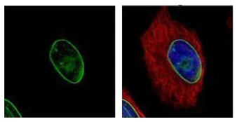 Immunocytochemistry/ Immunofluorescence - Anti-Lamin A + Lamin C antibody (AB227176)