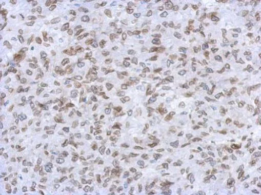 Immunohistochemistry (Formalin/PFA-fixed paraffin-embedded sections) - Anti-Lamin A + Lamin C antibody (AB227176)