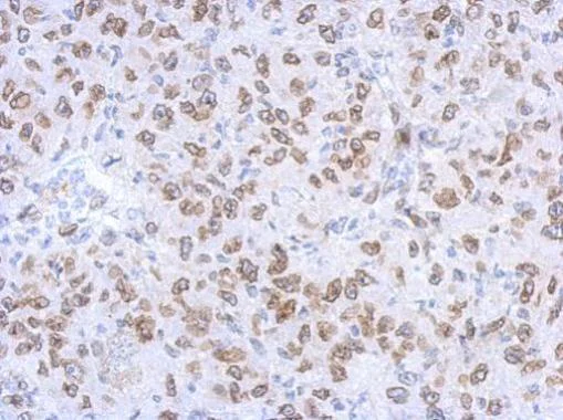 Immunohistochemistry (Formalin/PFA-fixed paraffin-embedded sections) - Anti-Lamin A + Lamin C antibody (AB227176)