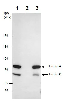 Immunoprecipitation - Anti-Lamin A + Lamin C antibody (AB227176)
