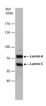 Western blot - Anti-Lamin A + Lamin C antibody (AB227176)