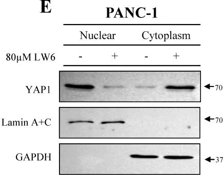 Western blot - Anti-Lamin A + Lamin C antibody [EP4520-16] (AB133256)