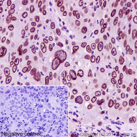 Immunohistochemistry (Formalin/PFA-fixed paraffin-embedded sections) - Anti-Lamin A + Lamin C antibody [EPR4100] - BSA and Azide free (AB216074), expandable thumbnail
