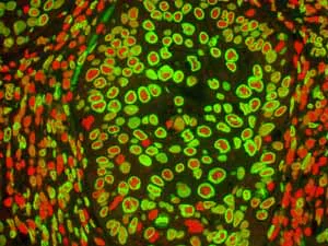 Immunohistochemistry (Formalin/PFA-fixed paraffin-embedded sections) - Anti-Lamin A + Lamin C antibody [EPR4100] - BSA and Azide free (AB216074)