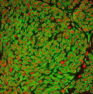 Immunohistochemistry (Formalin/PFA-fixed paraffin-embedded sections) - Anti-Lamin A + Lamin C antibody [EPR4100] - BSA and Azide free (ab216074), expandable thumbnail