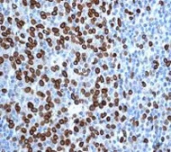 Immunohistochemistry (Formalin/PFA-fixed paraffin-embedded sections) - Anti-Lamin A + Lamin C antibody [EPR4100] - BSA and Azide free (AB216074)