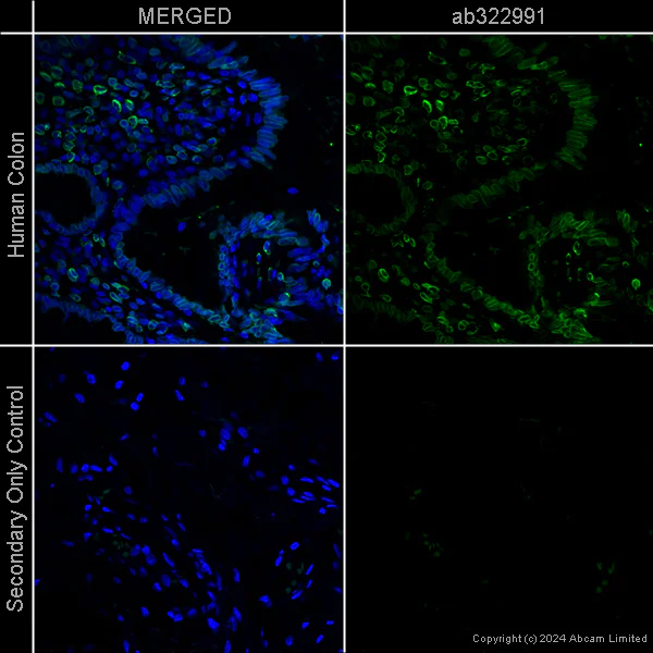 Immunohistochemistry (Formalin/PFA-fixed paraffin-embedded sections) - Anti-Lamin A + Lamin C antibody [EPR4100] - Mouse IgG2a (Chimeric) - BSA and Azide free (AB322997)