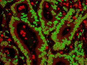 Immunohistochemistry (Formalin/PFA-fixed paraffin-embedded sections) - Anti-Lamin A + Lamin C antibody [EPR4100] - Nuclear Envelope Marker (AB108595)