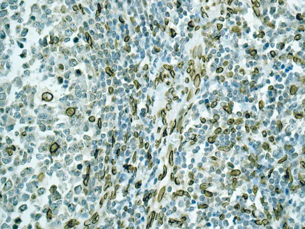 Immunohistochemistry (Formalin/PFA-fixed paraffin-embedded sections) - Anti-Lamin A + Lamin C antibody [EPR4519(2)] (AB169532)