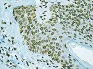 Immunohistochemistry (Formalin/PFA-fixed paraffin-embedded sections) - Anti-Lamin A + Lamin C antibody [EPR4519(2)] (AB169532)