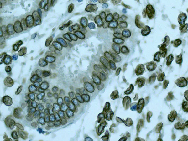 Immunohistochemistry (Formalin/PFA-fixed paraffin-embedded sections) - Anti-Lamin A + Lamin C antibody [EPR4519(2)] (AB169532)
