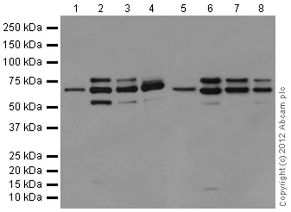 Western blot - Anti-Lamin A + Lamin C antibody [EPR4519(2)] (AB169532)