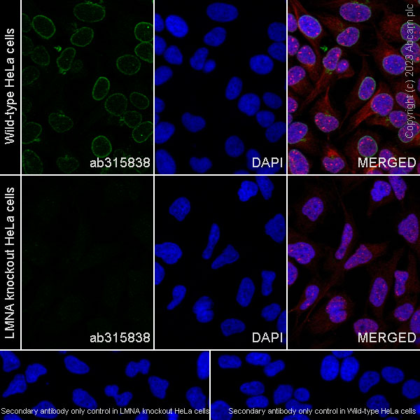 Immunocytochemistry/ Immunofluorescence - Anti-Lamin A + Lamin C antibody [RM1093] (ab315838), expandable thumbnail