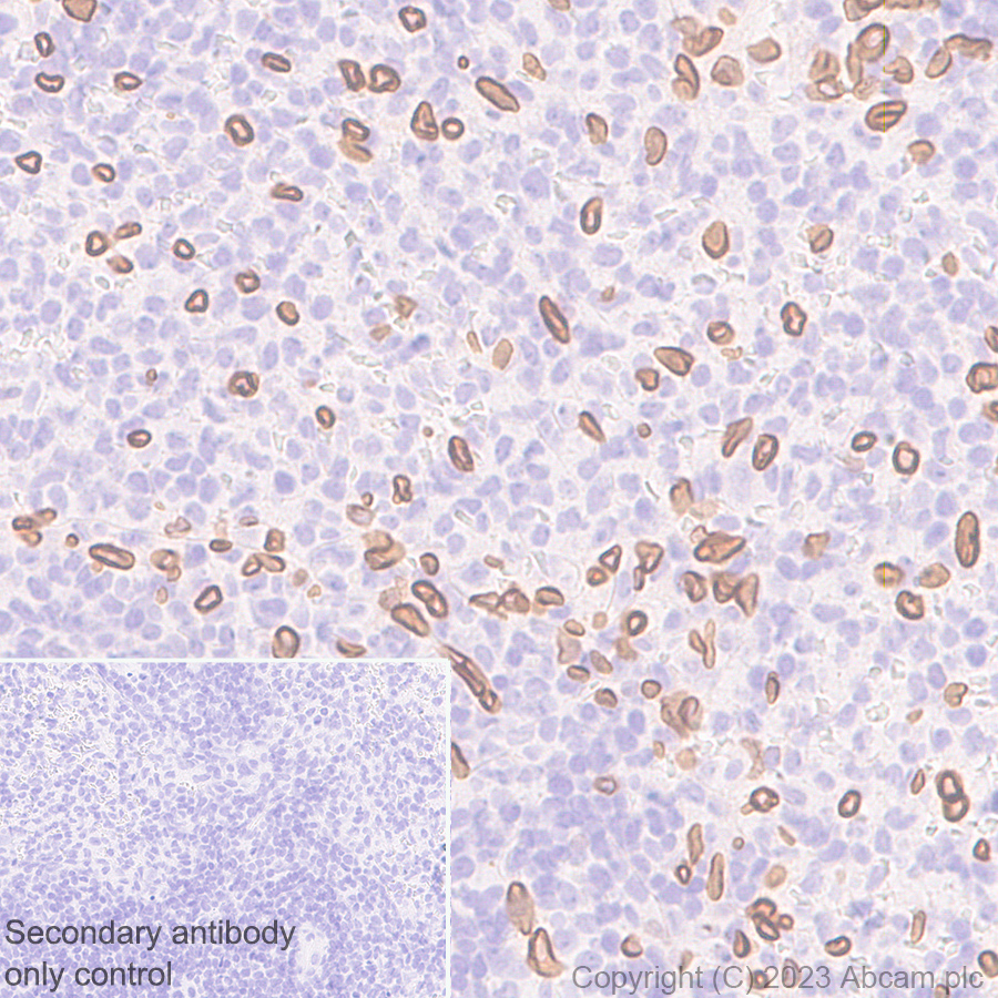 Immunohistochemistry (Formalin/PFA-fixed paraffin-embedded sections) - Anti-Lamin A + Lamin C antibody [RM1093] (AB315838), expandable thumbnail