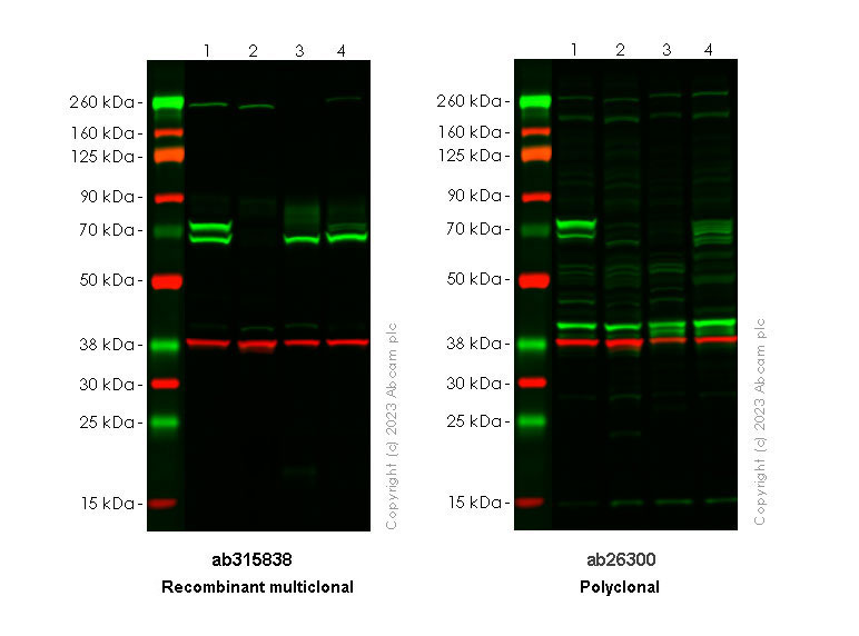 Western blot - Anti-Lamin A + Lamin C antibody [RM1093] (AB315838), expandable thumbnail