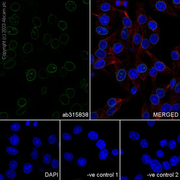 Immunocytochemistry/ Immunofluorescence - Anti-Lamin A + Lamin C antibody [RM1093] - BSA and Azide free (AB315839)