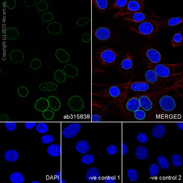 Immunocytochemistry/ Immunofluorescence - Anti-Lamin A + Lamin C antibody [RM1093] - BSA and Azide free (AB315839)