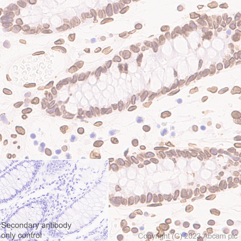 Immunohistochemistry (Formalin/PFA-fixed paraffin-embedded sections) - Anti-Lamin A + Lamin C antibody [RM1093] - BSA and Azide free (AB315839)