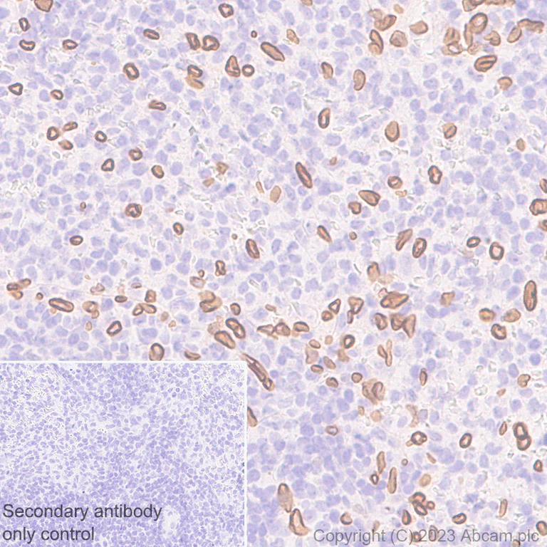 Immunohistochemistry (Formalin/PFA-fixed paraffin-embedded sections) - Anti-Lamin A + Lamin C antibody [RM1093] - BSA and Azide free (AB315839)