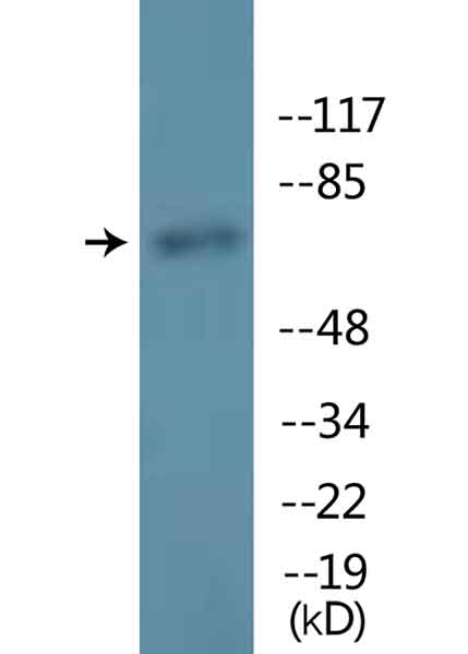 Western blot - Anti-Lamin A + Lamin C (phospho S22) antibody (AB138450)