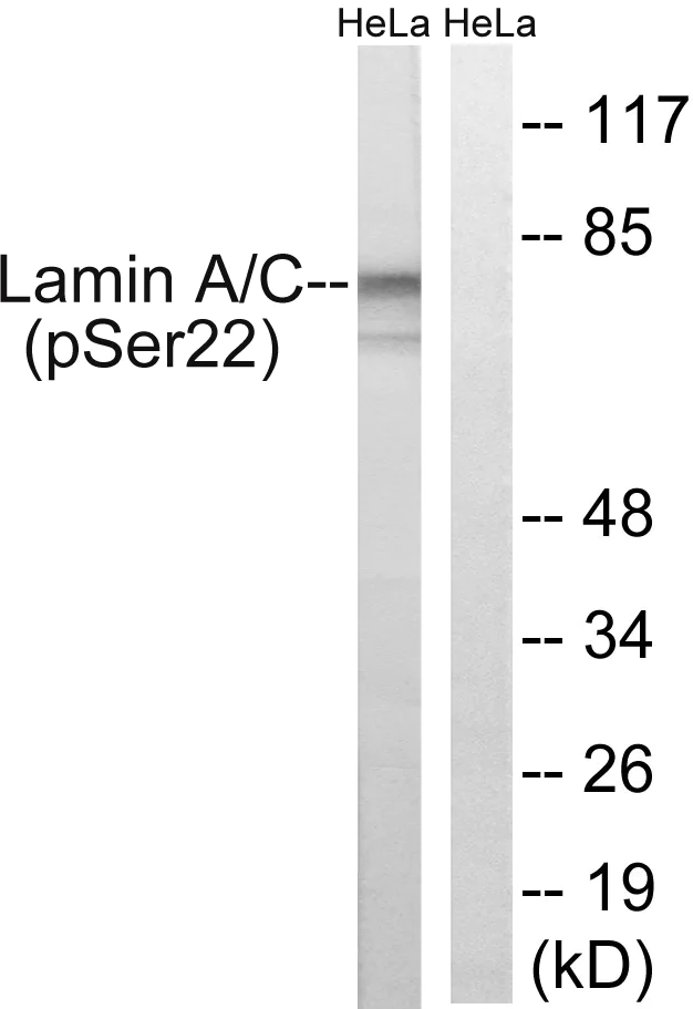 Western blot - Anti-Lamin A + Lamin C (phospho S22) antibody (AB138450)
