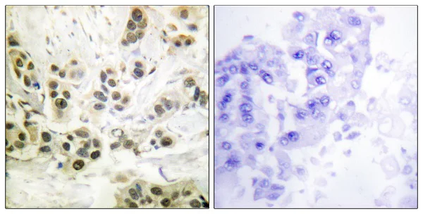 Immunohistochemistry (Formalin/PFA-fixed paraffin-embedded sections) - Anti-Lamin A + Lamin C (phospho S392) antibody (AB58528)
