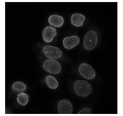 Immunocytochemistry/ Immunofluorescence - Anti-Lamin B Receptor/LBR antibody (AB122919), expandable thumbnail