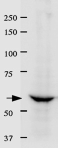 Immunoprecipitation - Anti-Lamin B Receptor/LBR antibody (AB122919), expandable thumbnail
