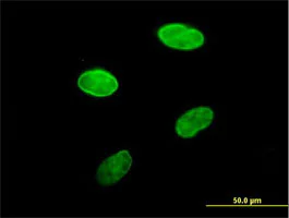 Immunocytochemistry/ Immunofluorescence - Anti-Lamin B Receptor/LBR antibody (AB169306)