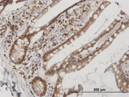 Immunohistochemistry (Formalin/PFA-fixed paraffin-embedded sections) - Anti-Lamin B Receptor/LBR antibody (AB169306)