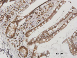 Immunohistochemistry (Formalin/PFA-fixed paraffin-embedded sections) - Anti-Lamin B Receptor/LBR antibody (AB169306)
