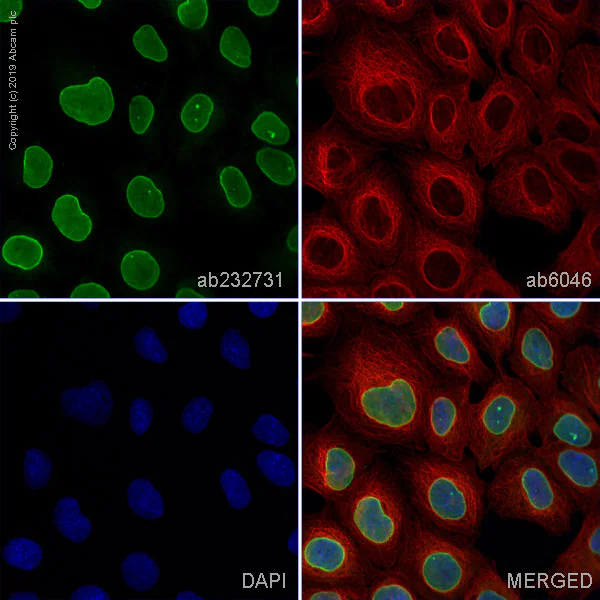 Immunocytochemistry/ Immunofluorescence - Anti-Lamin B Receptor/LBR antibody [BBmLBR 12.F8] - BSA and Azide free (AB269576)